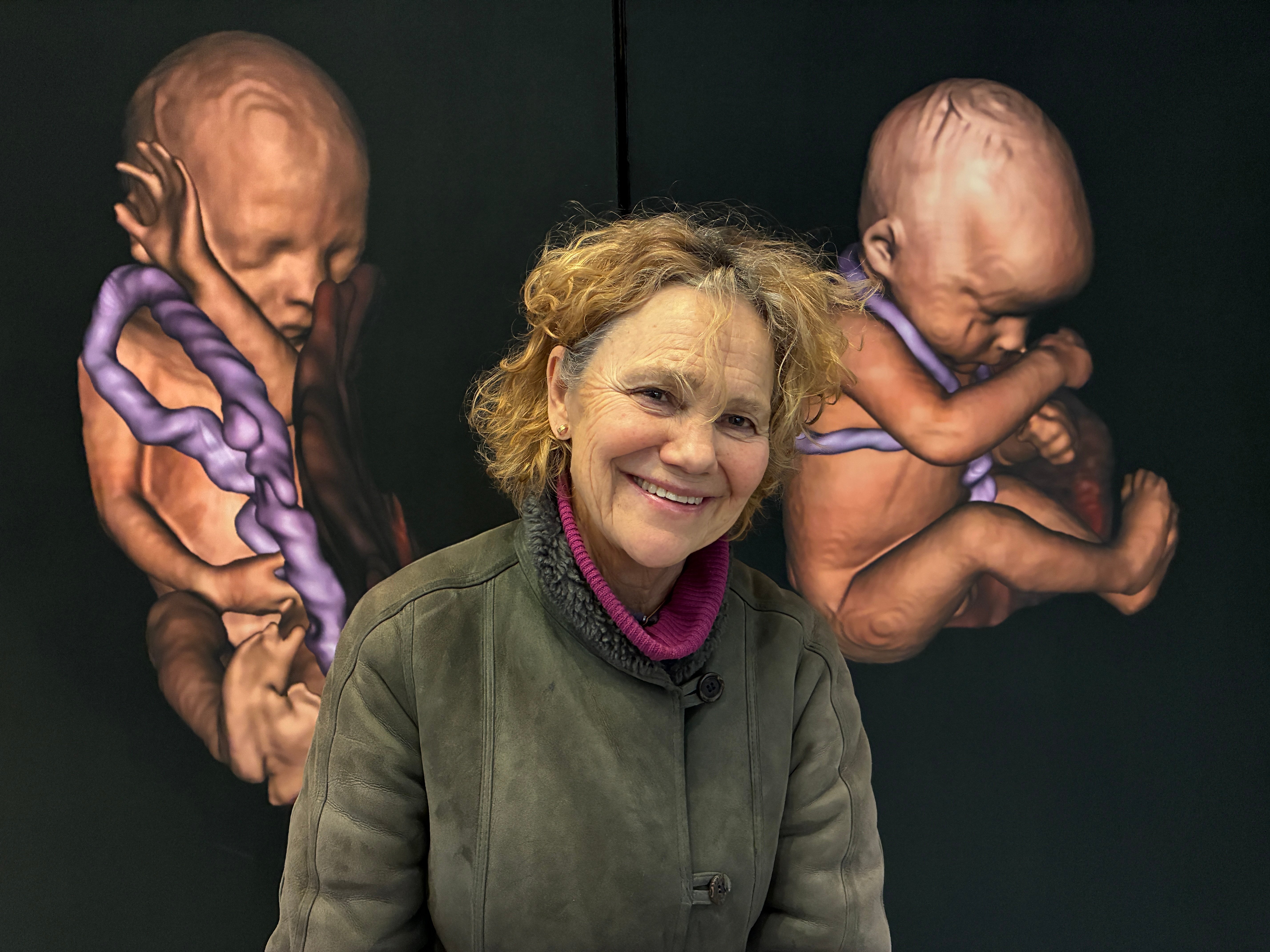 Professor ved kvinneklinikken på Ahus Anne Eskild