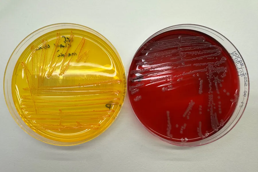 Noen få forskjellige fargede mynter