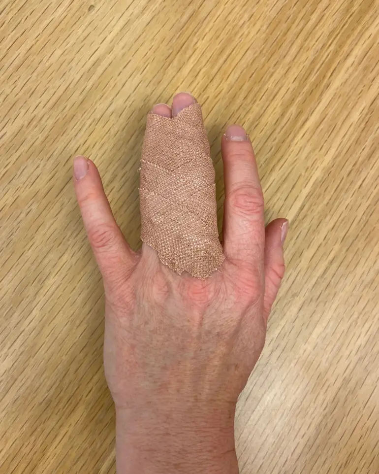 A hand with a thumb up