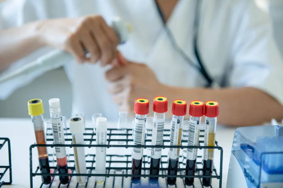 En person som setter en flaske væske i en beholder