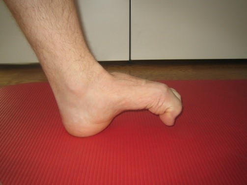 Et nærbilde av en fot