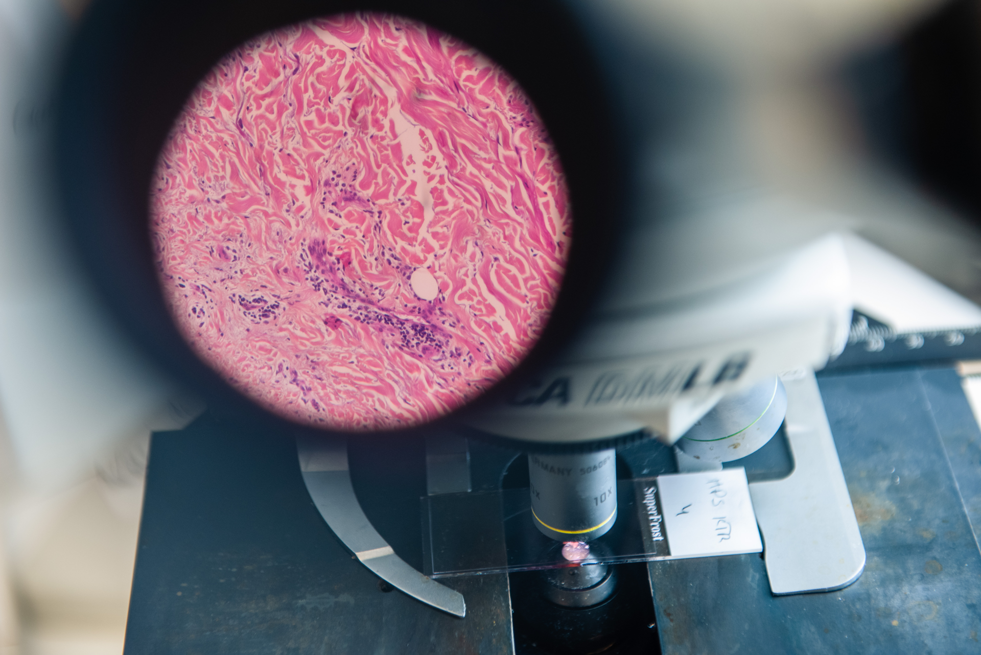 En rosa sfærisk gjenstand på en svart overflate