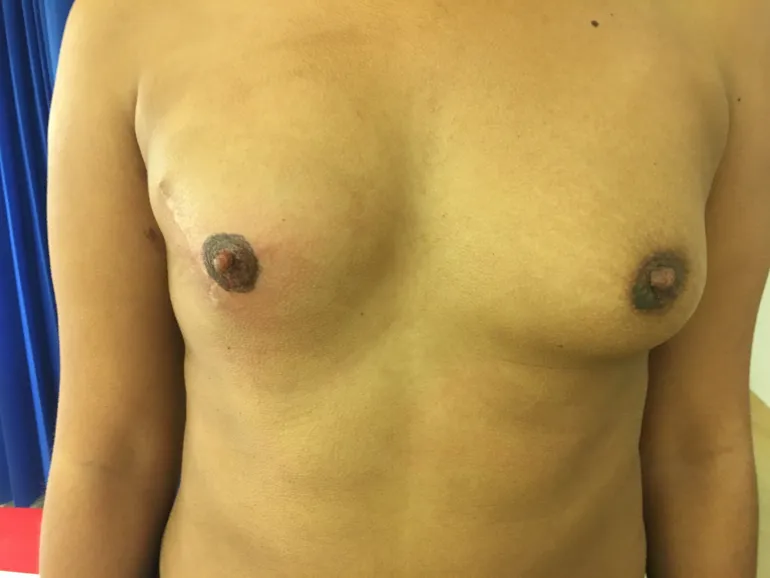 Etter første tatoveringstime