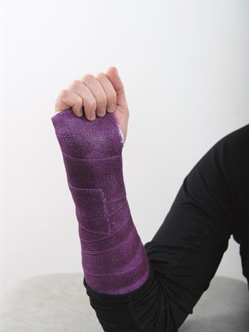 Gipset arm med knytt hånd