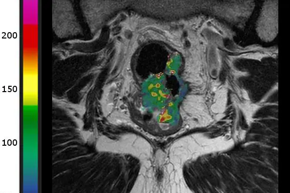 Et nærbilde av et dyr