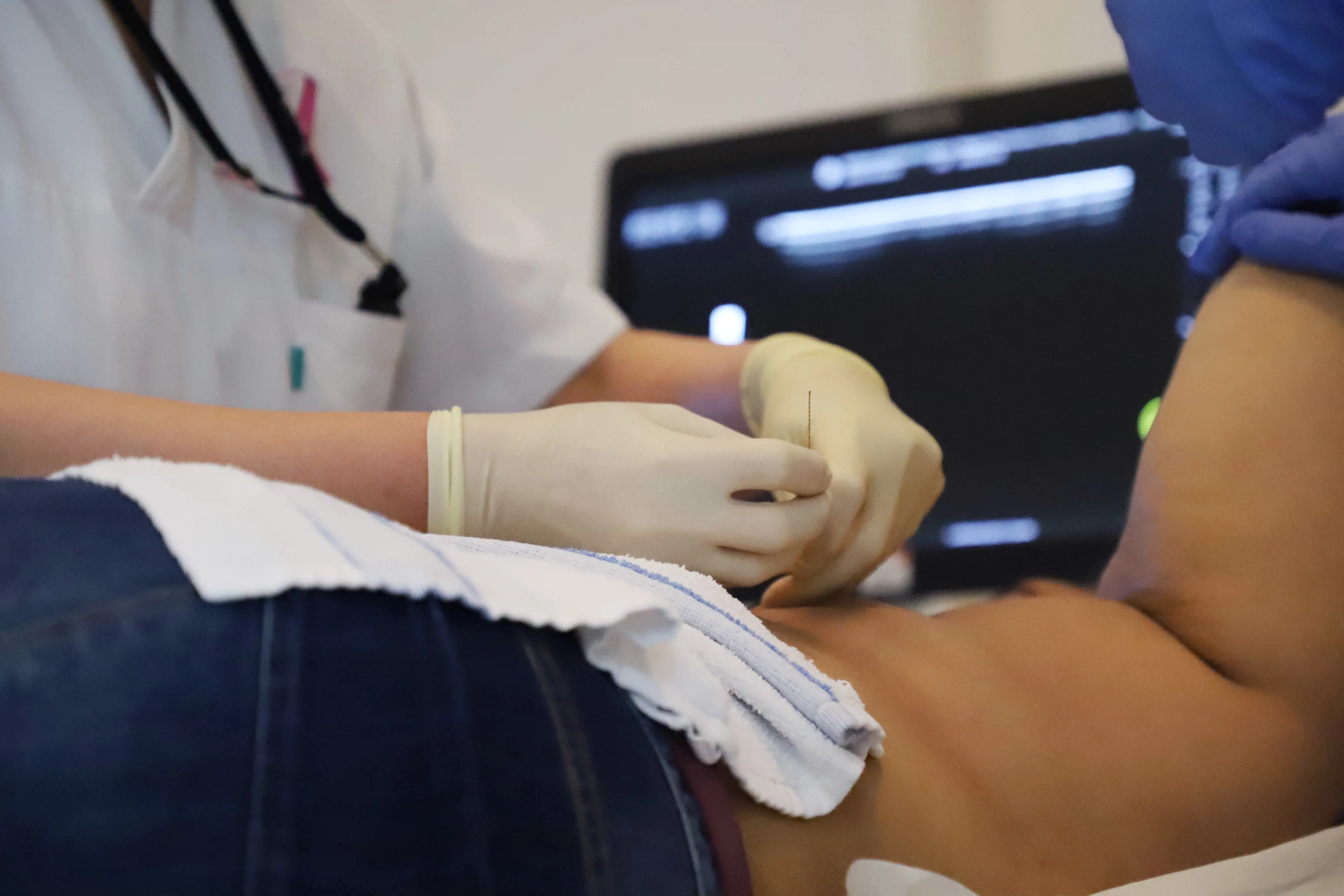 Radiolog plasserer en brystmarkør i en pasient ved hjelp av en liten nål.