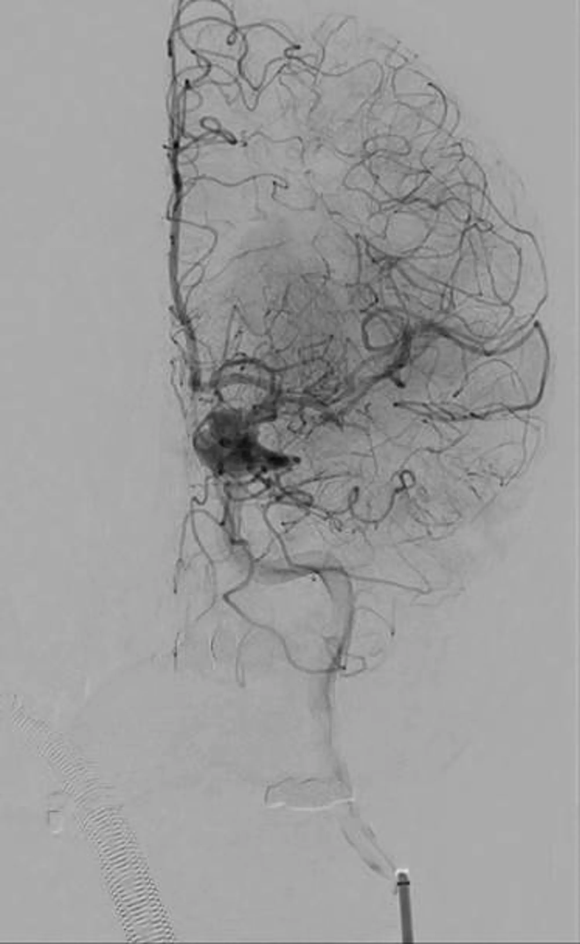 CT-scan