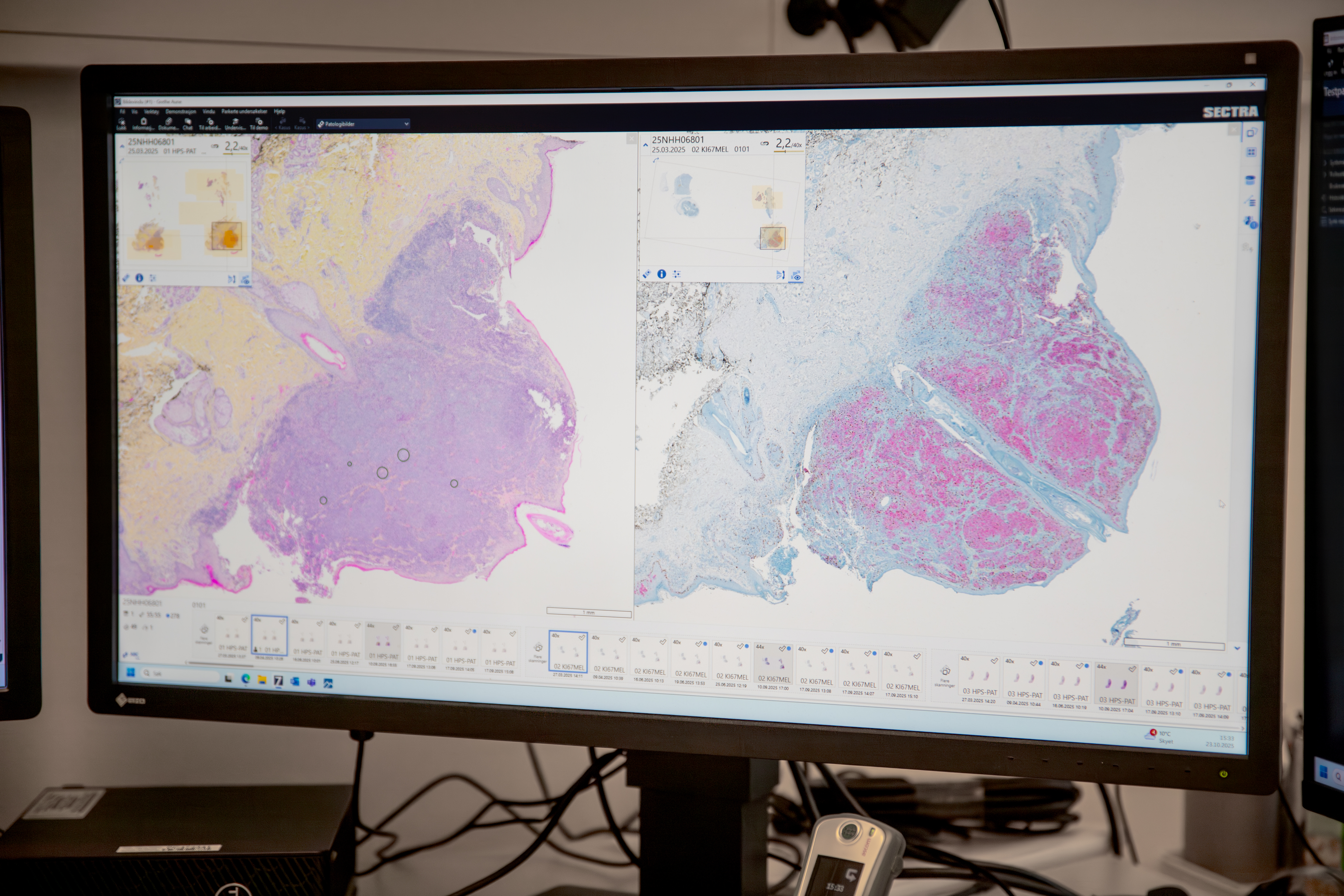 Digital patologi på skjerm