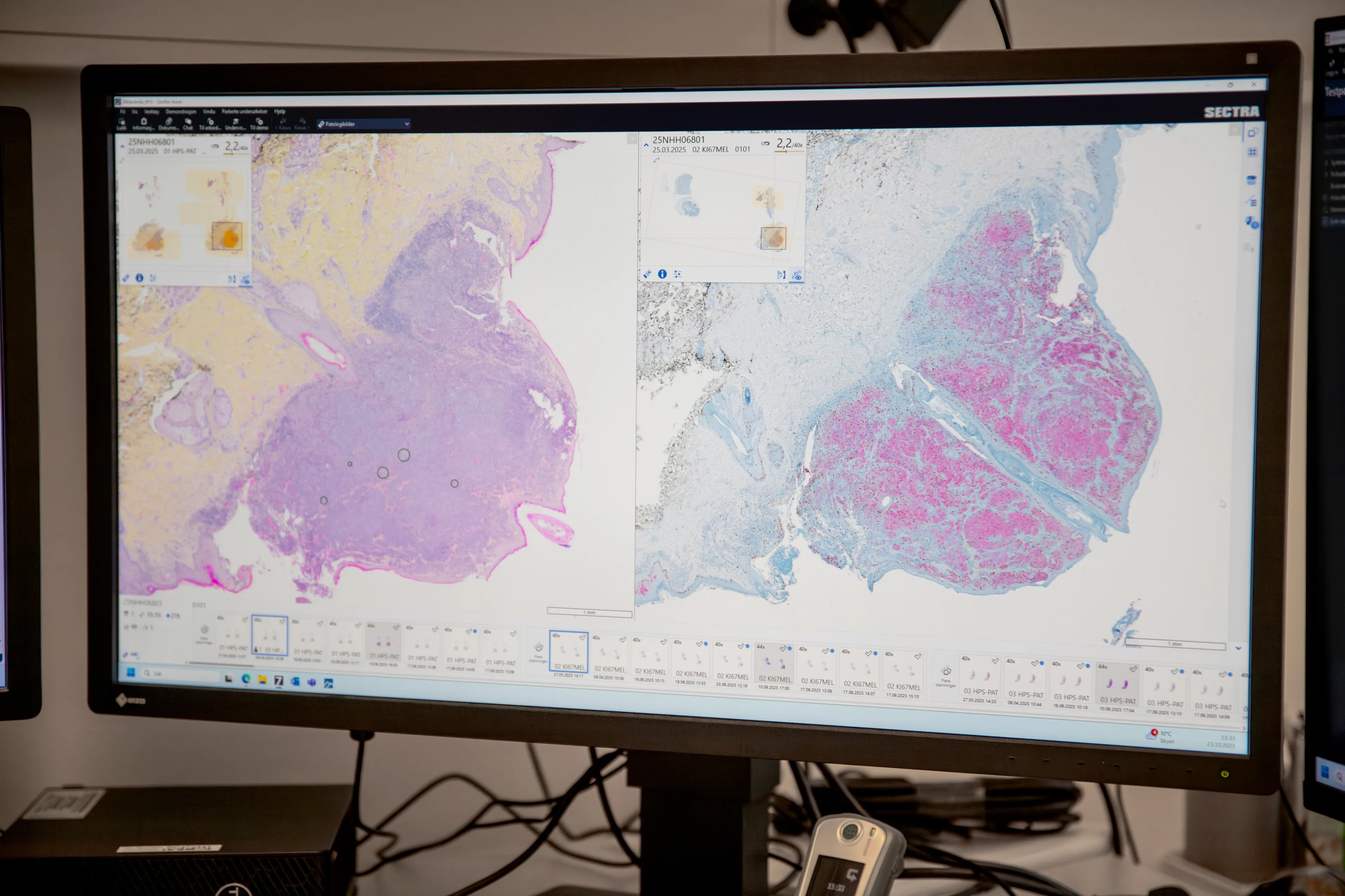 Digital patologi på skjerm